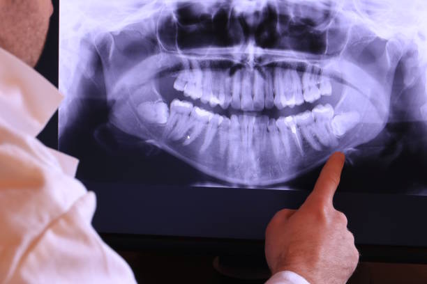 Best Walk-In Emergency Dentist in Twentynine Palms, CA