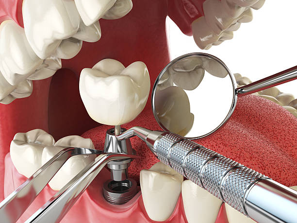 Best Emergency Treatment for Toothache in Twentynine Palms, CA